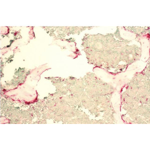 Lumenera INFINITY2-2C, CCD, color, 2.0 MP