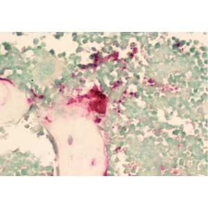 Lumenera INFINITY2-2C, CCD, color, 2.0 MP