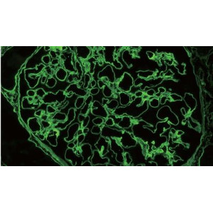 Olympus Mikroskop CX43 Ergo, LED