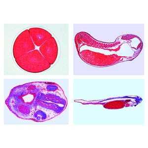 LIEDER Entwicklung des Froschembryos (Rana sp)  (10 Präp)