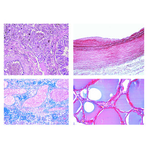 LIEDER Pathologische Histologie des Menschen, kleine Serie (50 Präp)