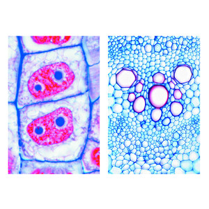 LIEDER Pflanzenzelle (Cytologie), Basis (6 Präp), Schülersatz