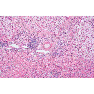 Nikon DS-Ri2, Color, 16.25MP, USB3.0, CMOS, F-mount