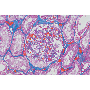 Nikon DS-Ri2, Color, 16.25MP, USB3.0, CMOS, F-mount