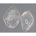 Phasenkontrast, Epithelzellen