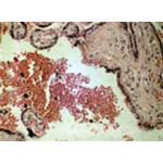 PlazentaHellfeldHE Färbung