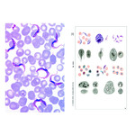 LIEDER Mikroskopische Präparate Parasiten, 6 Präp.