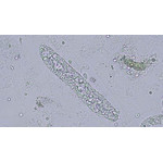 Hellfeld (Harnzylinder)