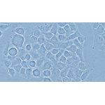 Phasenkontrast (Hela Zellen)