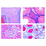 LIEDER Sekundarstufe, Set  IV Hormone und Hormonfunktion (7 Präp)