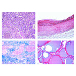 LIEDER Pathologische Histologie des Menschen, kleine Serie  (50 Präp)