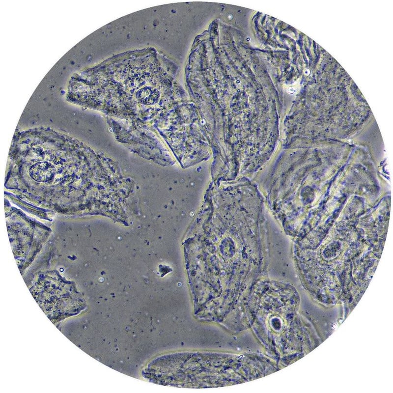 Microscope Optika Mikroskop B 510phivd Trino Phase W Plan Ios 40x 1000x Eu Ivd